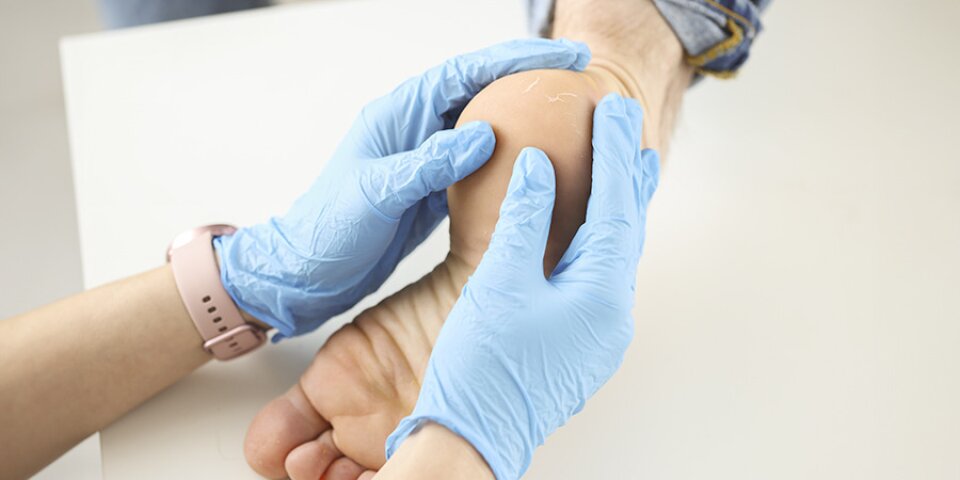 Œil-de-perdrix : l'identifier, le traiter, l'éviter | Pharmacie en