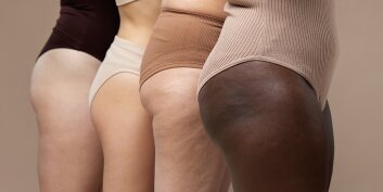4 astuces pour se débarrasser de la cellulite