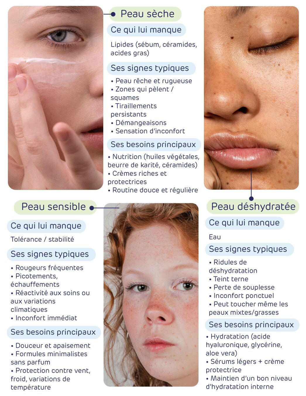 Peau sèche et sensible : pourquoi faut-il protéger sa barrière cutanée en hiver ? - 7