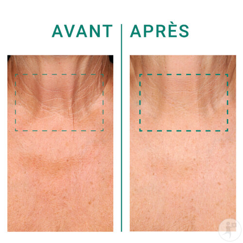 Dr. Pierre Ricaud Hals Und Dekolleté Lifting Creme Mit Vitamin B3 Und Süßem Mandel Biopolymer 50ml-3