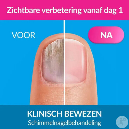 Excilor Forte Behandlung Von Nagelpilz Extra Fort 30ml-5