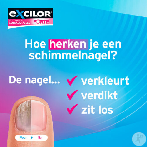 Excilor Forte Behandlung Von Nagelpilz Extra Fort 30ml-7