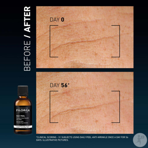 Filorga Daily Peel Resurfacing Anti-Falten-Lösung 50ml-7