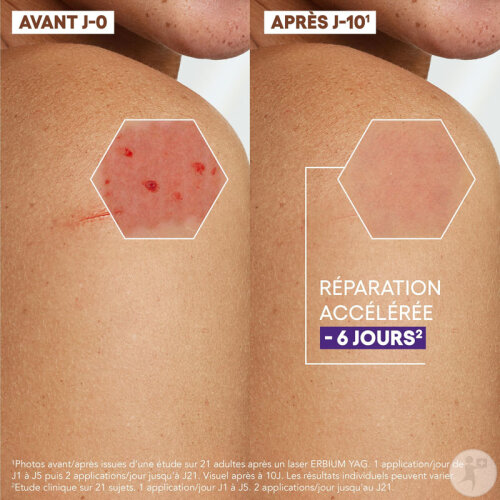 A-Derma Epitheliale Ultra Repair Crème Réparatrice Anti-Marques 100ml ...
