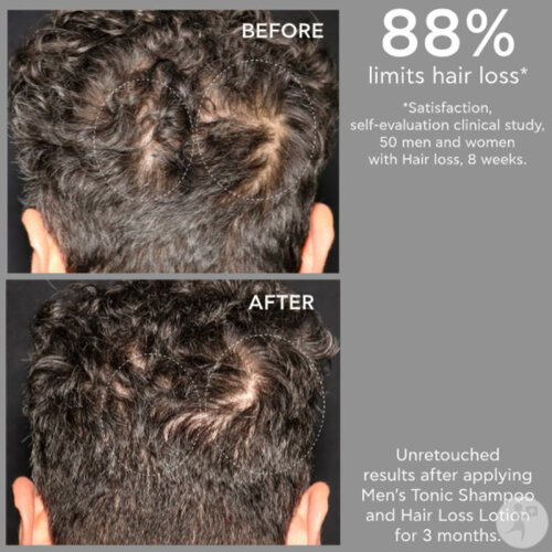 Apivita Shampoing Tonique Pour Hommes Cheveux Clairsemés Ecopack 500ml-4