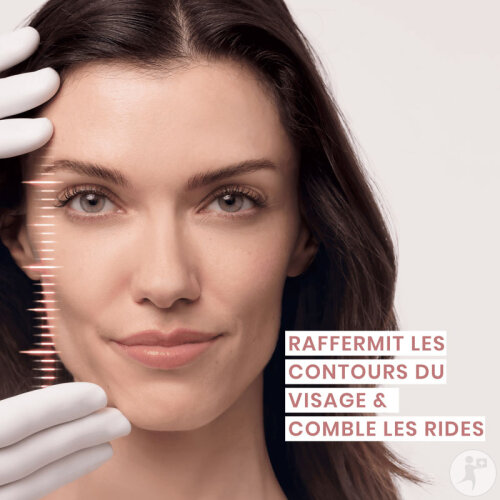 Avène Hyaluron Activ Procedure Retinal 0,05% Crème Anti-Âge Micro-Lift Yeux & Lèvres 15ml-6