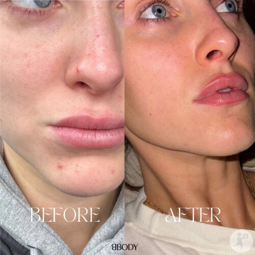 BBody 100% Collagène Hydrolysé 300g-3