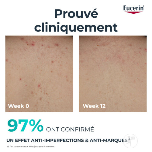 Eucerin Dermopure Clinical Crème Pour Le Corps Triple Action 200ml-3