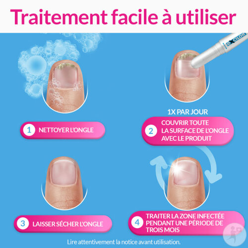 Laser Ongle Mycose Avis
