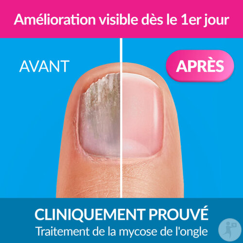 Excilor Forte Traitement De La Mycose De L'Ongle Extra Fort 30ml-3