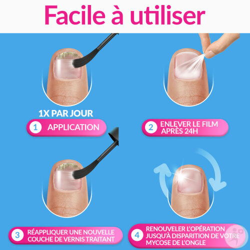 Excilor Forte Traitement De La Mycose De L'Ongle Extra Fort 30ml-5