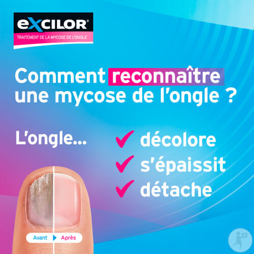 Excilor Forte Traitement De La Mycose De L'Ongle Extra Fort 30ml-7