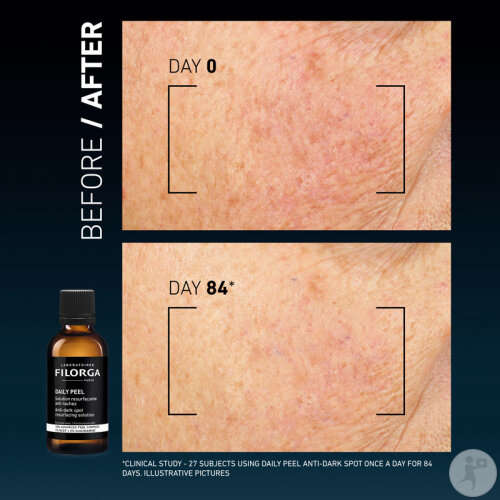 Filorga Daily Peel Solution Resurfaçante Anti-Tâches 50ml-7