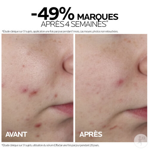 La Roche-Posay Effaclar Sérum Visage Anti-Imperfections Micro-Peeling Peaux Tendance Acnéique 30ml-4
