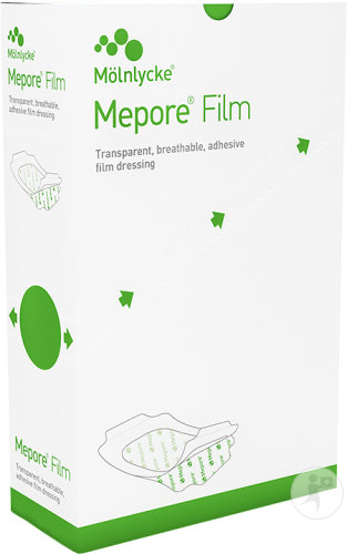 Mepore Film 6x7cm 100 Pièces