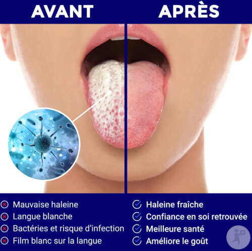 Oravix Gratte-Langue U En Acier Inoxydable 1 Pièce-2