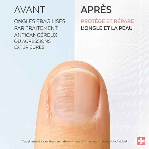 Poderm Sérum Ongles Fragilisés Au Silicium Protection Complète Ongles Et Contour 8ml-3