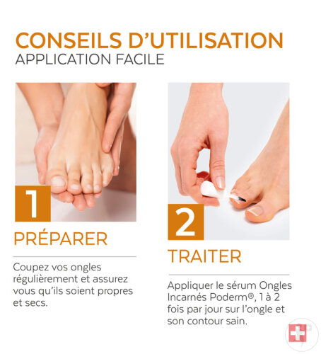Poderm Sérum Ongles Incarnés Émollient Et Soulage La Douleur 8ml-5