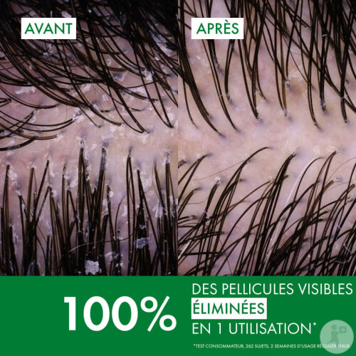 Vichy Dercos Anti-Pelliculaire Shampoing Traitant Cheveux Normaux A Gras Flacon 200ml-4
