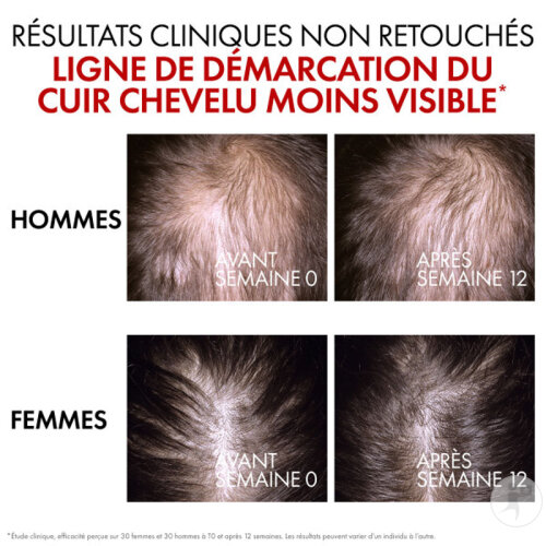 Vichy Dercos Sérum R.E.G.E.N Booster Régénératif Capillaire Flacon 90ml-7