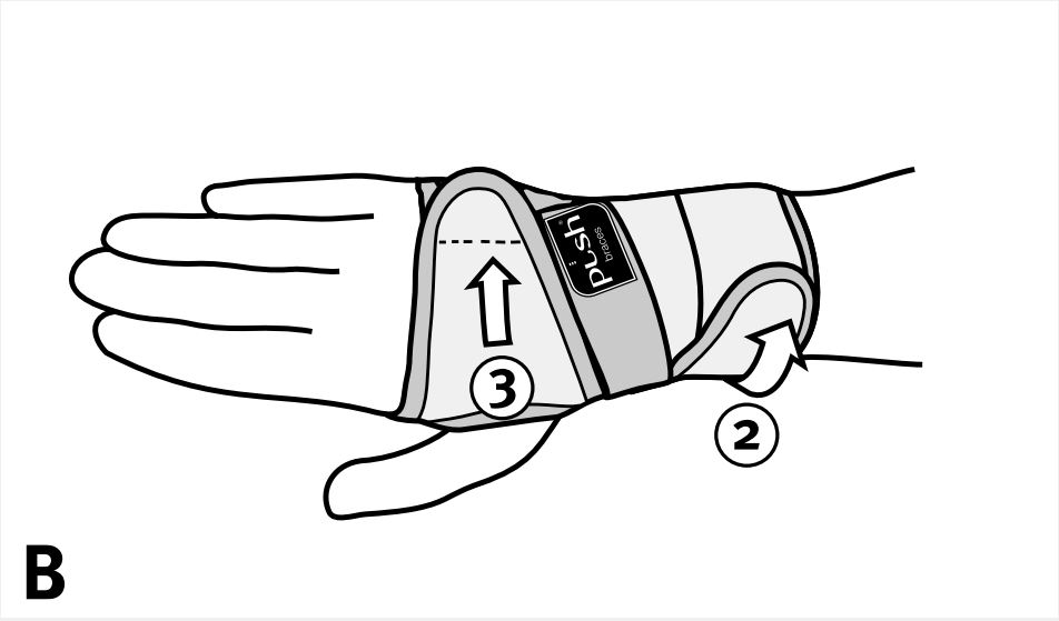 Push Braces Med Splint Handgelenkbandage Links Gr&ouml;&szlig;e 2 St&uuml;ck 1 - Onlineapotheke - 3