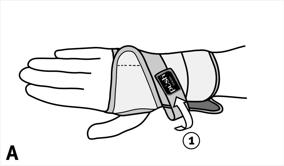 Push Braces Med Splint Handgelenkbandage Rechts Gr&ouml;&szlig;e 4 St&uuml;ck 1 - Onlineapotheke - 2
